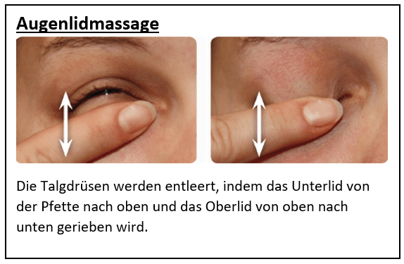 Blepharitis (Augenlidentzndung) Trkei Preis 2026 | Prof. Dr. Gkhan  GLKILIK